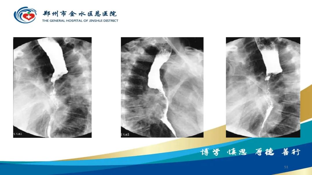 影像PPT - 【PPT】如何选择合适的影像学检查-51