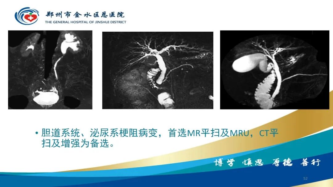 影像PPT - 【PPT】如何选择合适的影像学检查-52