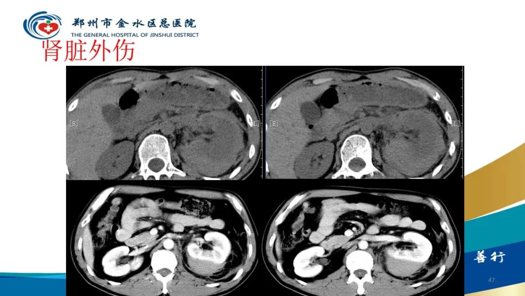 影像PPT - 【PPT】如何选择合适的影像学检查-47