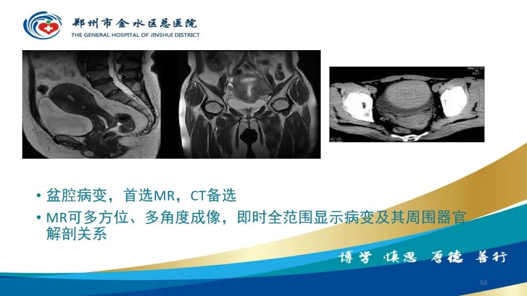 影像PPT - 【PPT】如何选择合适的影像学检查-53