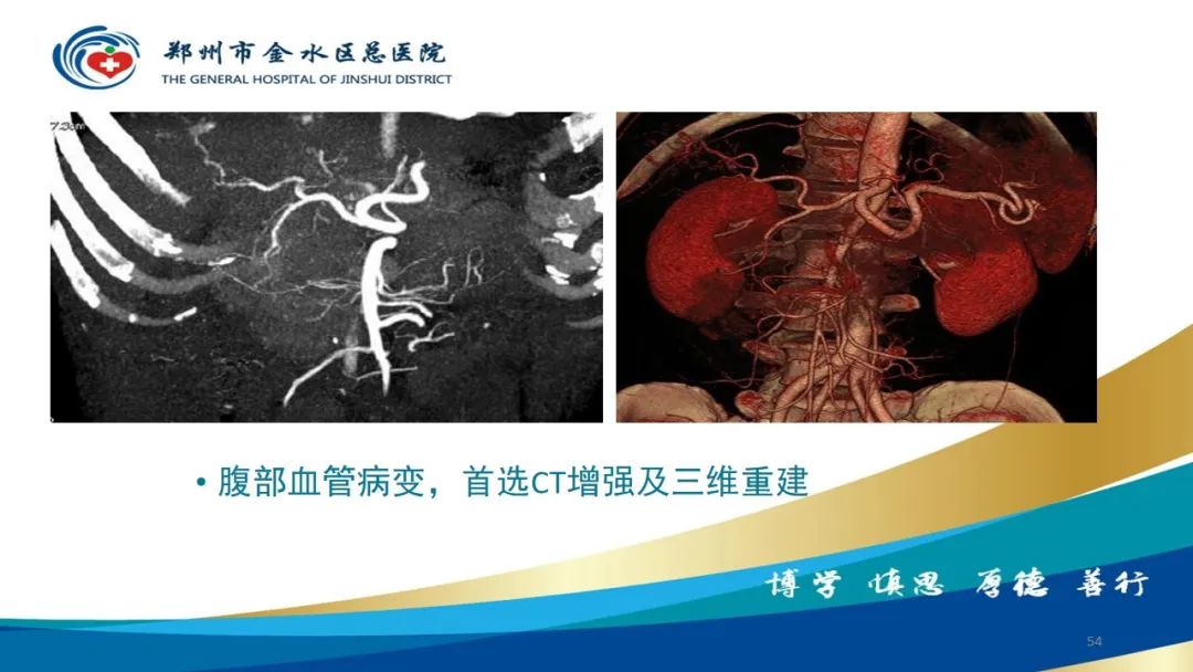 影像PPT - 【PPT】如何选择合适的影像学检查-54