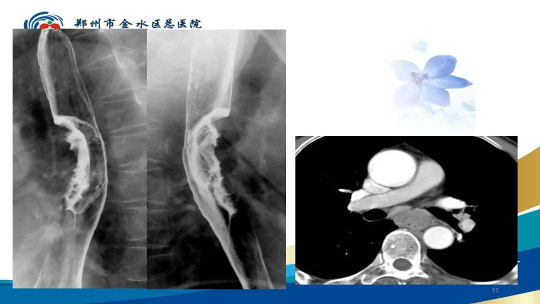 影像PPT - 【PPT】如何选择合适的影像学检查-55