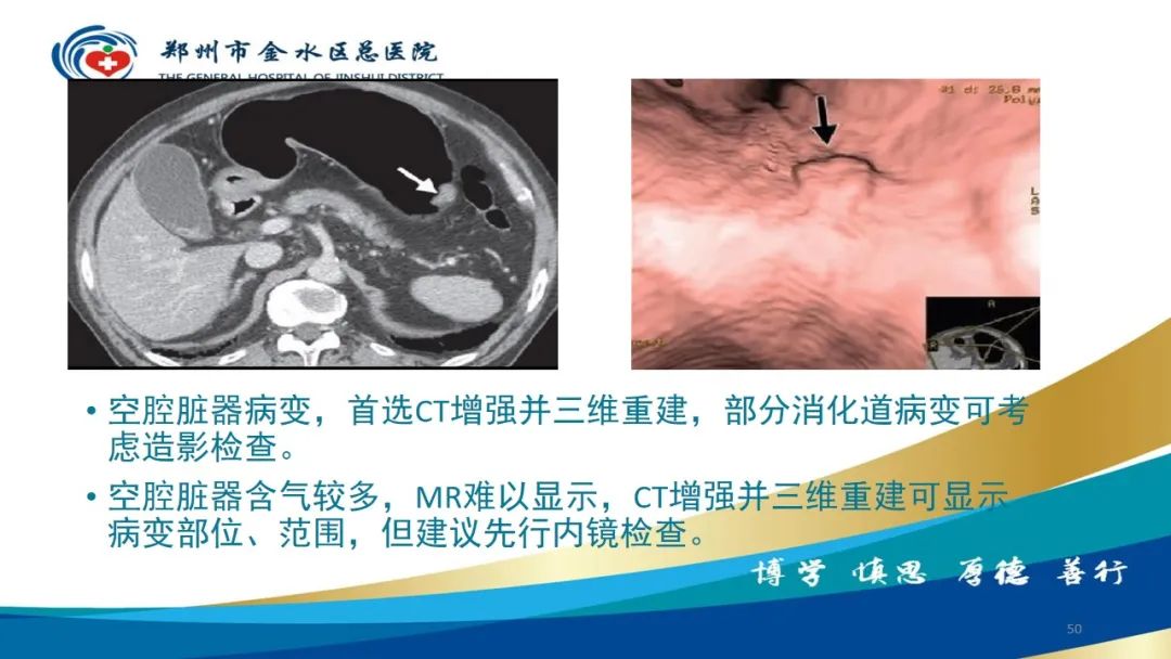 影像PPT - 【PPT】如何选择合适的影像学检查-50