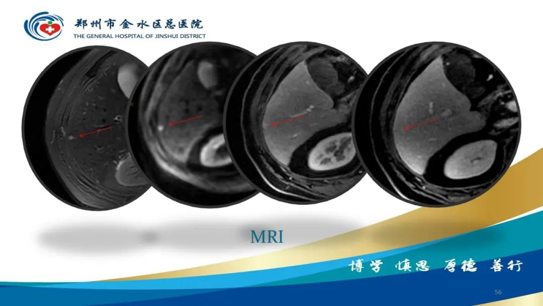 影像PPT - 【PPT】如何选择合适的影像学检查-56