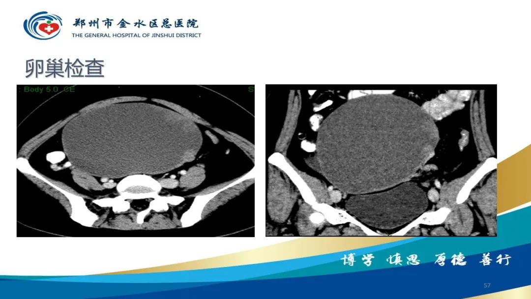 影像PPT - 【PPT】如何选择合适的影像学检查-57