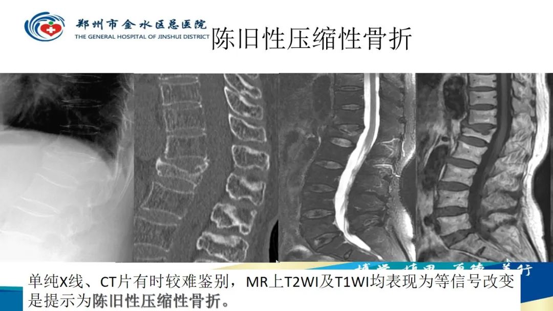 影像PPT - 【PPT】如何选择合适的影像学检查-61