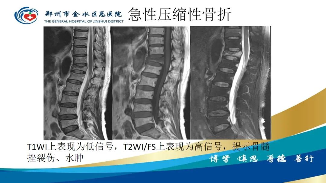 影像PPT - 【PPT】如何选择合适的影像学检查-62