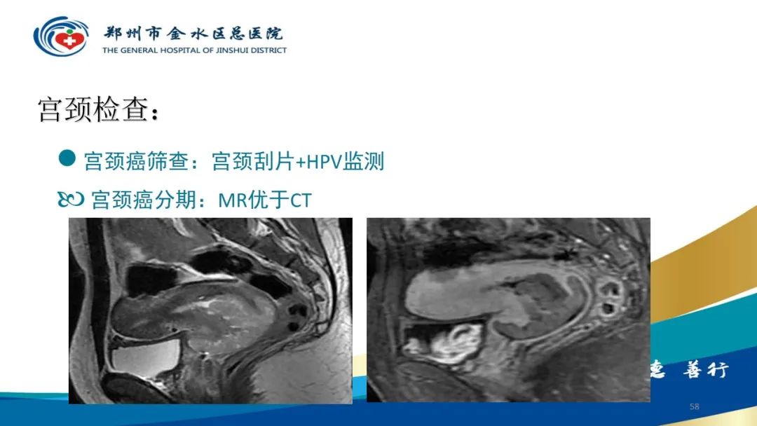 影像PPT - 【PPT】如何选择合适的影像学检查-58