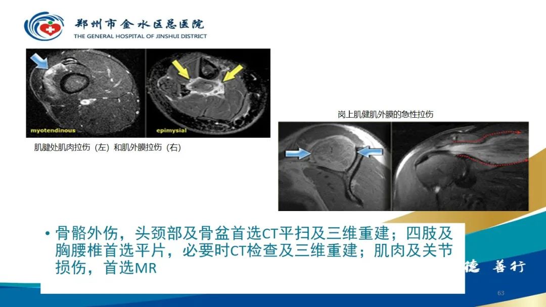 影像PPT - 【PPT】如何选择合适的影像学检查-63