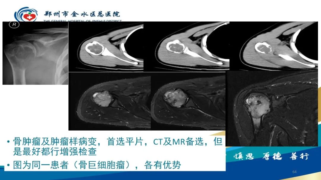 影像PPT - 【PPT】如何选择合适的影像学检查-64