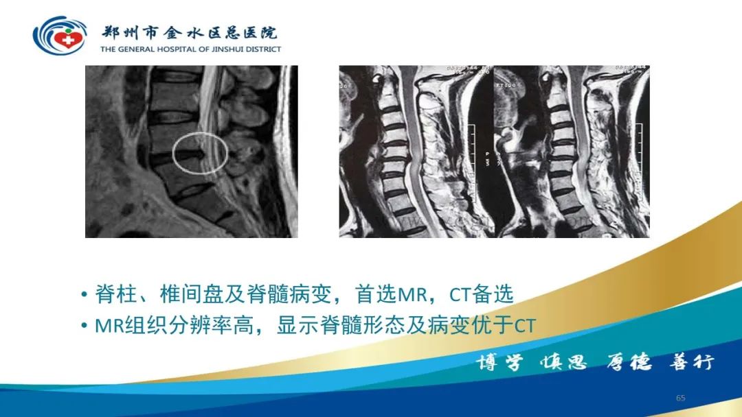 影像PPT - 【PPT】如何选择合适的影像学检查-65