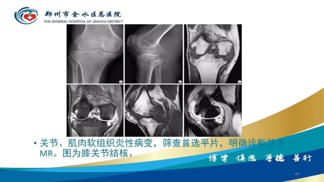影像PPT - 【PPT】如何选择合适的影像学检查-66