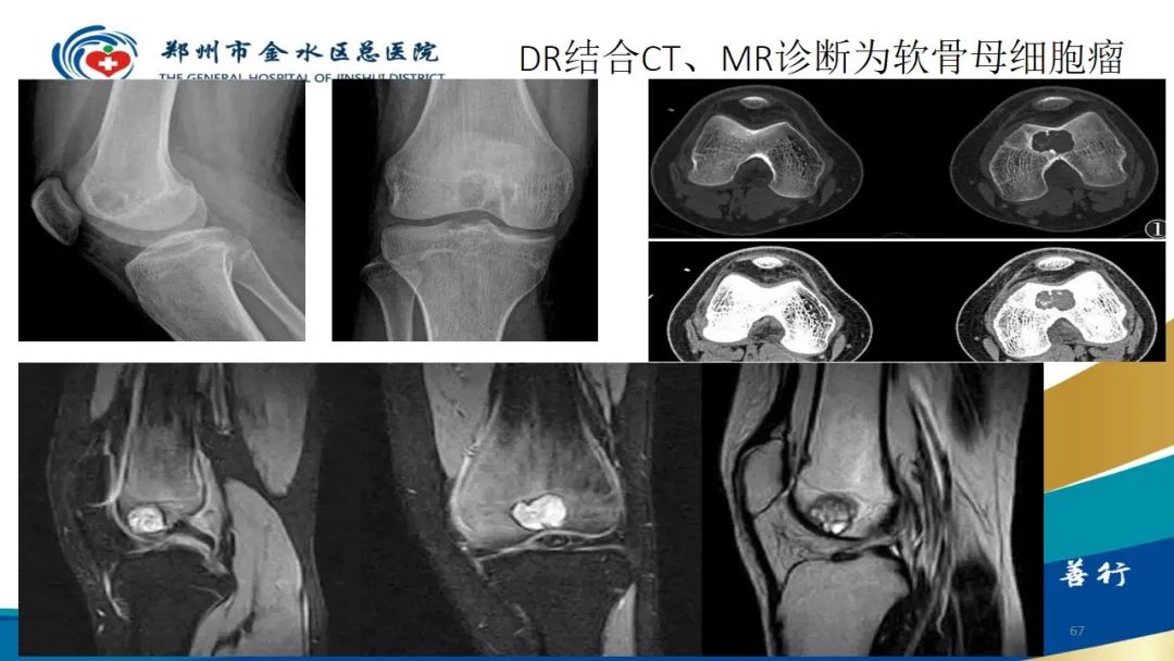 影像PPT - 【PPT】如何选择合适的影像学检查-67
