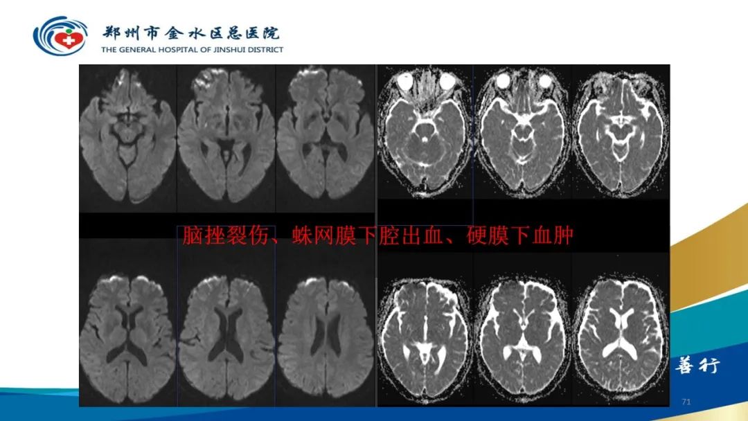 影像PPT - 【PPT】如何选择合适的影像学检查-71