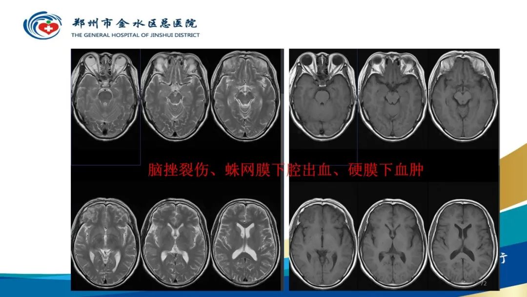 影像PPT - 【PPT】如何选择合适的影像学检查-72