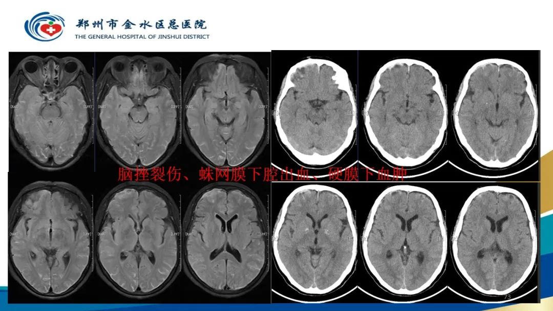 影像PPT - 【PPT】如何选择合适的影像学检查-73