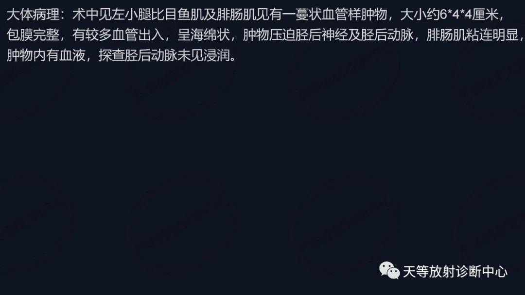 影像PPT - 【病例】软组织血管瘤1例MR-15 影像PPT - 【病例】软组织血管瘤1例MR-15
