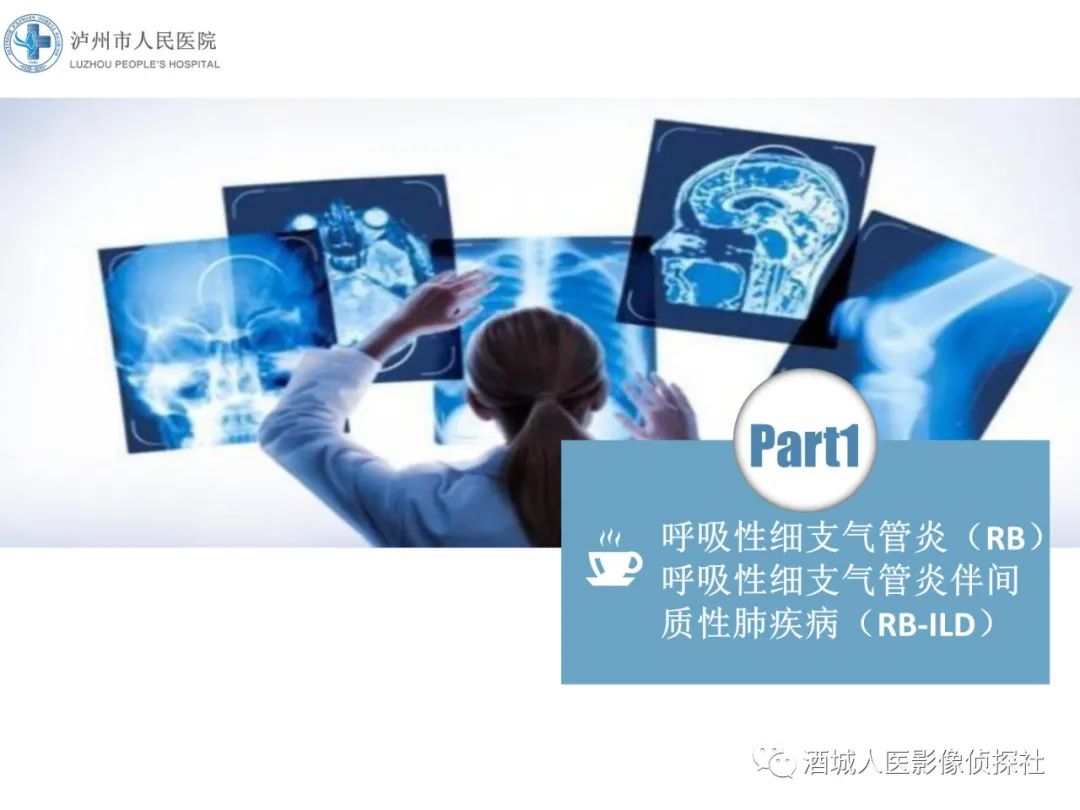 影像PPT - 【PPT】吸烟相关间质性肺疾病影像表现-2