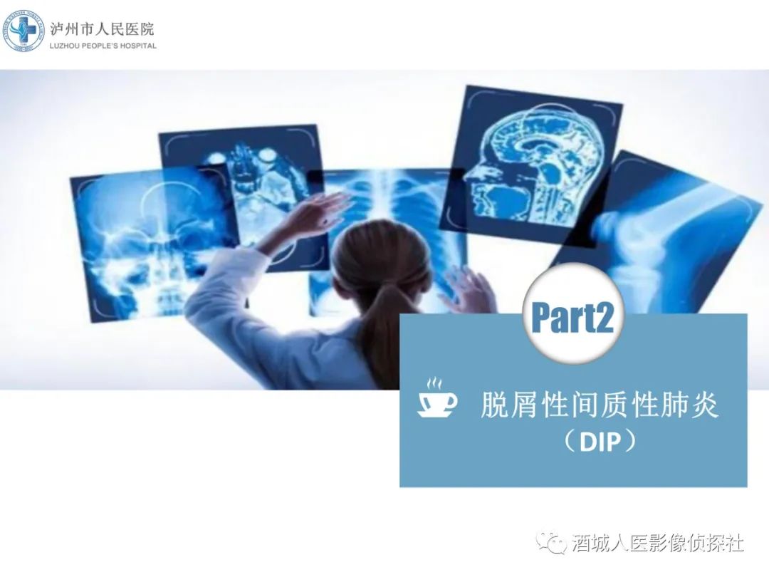 影像PPT - 【PPT】吸烟相关间质性肺疾病影像表现-11