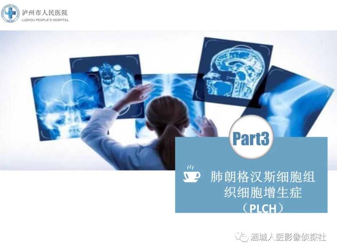 影像PPT - 【PPT】吸烟相关间质性肺疾病影像表现-18
