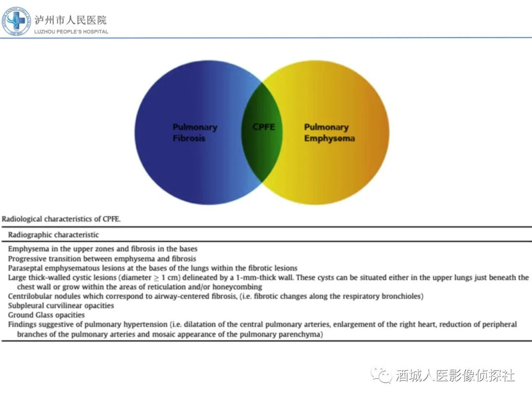 影像PPT - 【PPT】吸烟相关间质性肺疾病影像表现-31