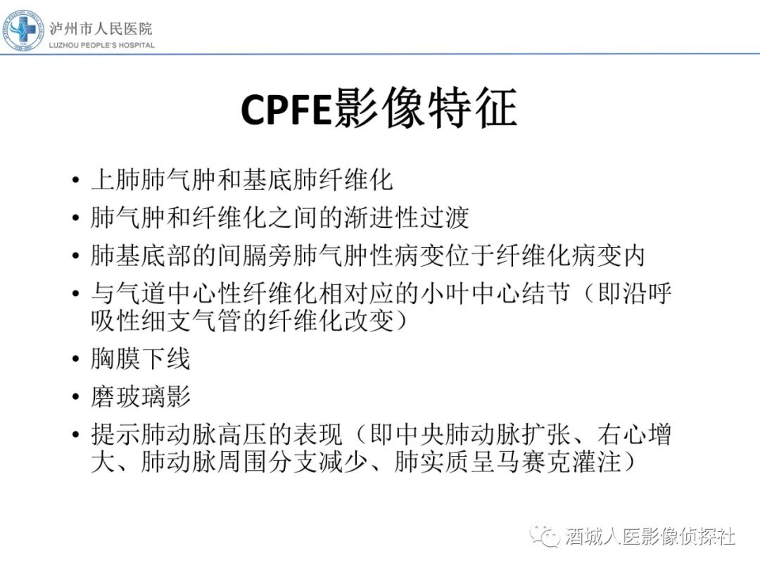 影像PPT - 【PPT】吸烟相关间质性肺疾病影像表现-32