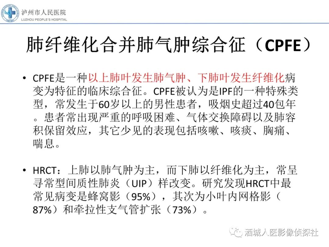 影像PPT - 【PPT】吸烟相关间质性肺疾病影像表现-30
