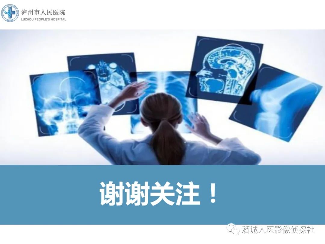 影像PPT - 【PPT】吸烟相关间质性肺疾病影像表现-50