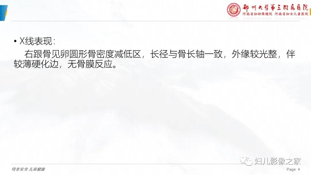 影像PPT - 【PPT】骨囊肿的鉴别诊断-4