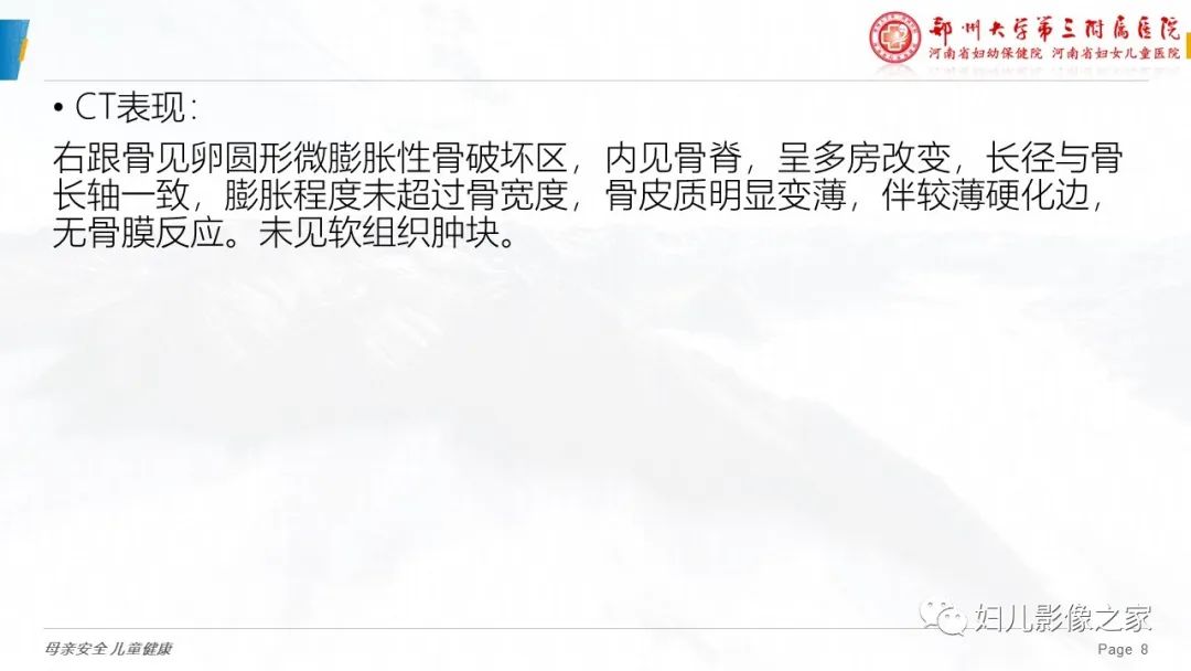 影像PPT - 【PPT】骨囊肿的鉴别诊断-8