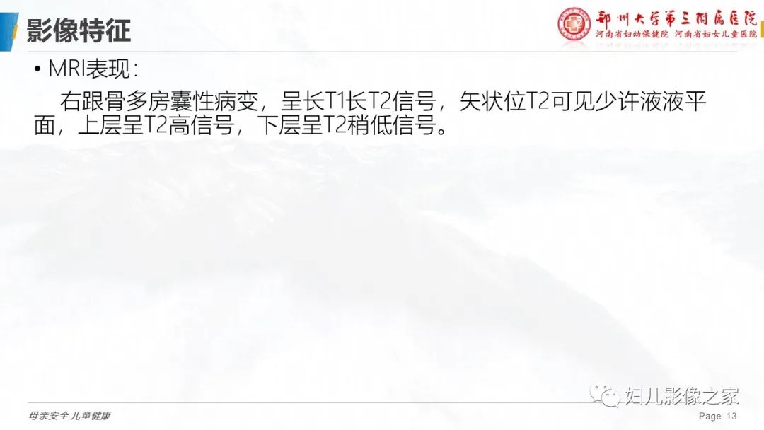 影像PPT - 【PPT】骨囊肿的鉴别诊断-13