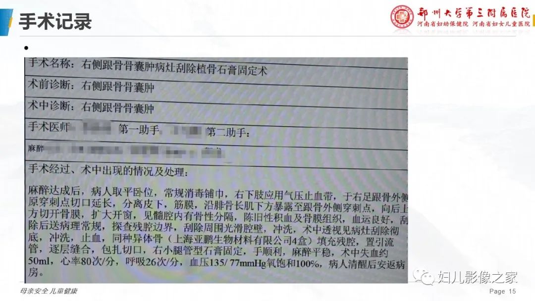 影像PPT - 【PPT】骨囊肿的鉴别诊断-15