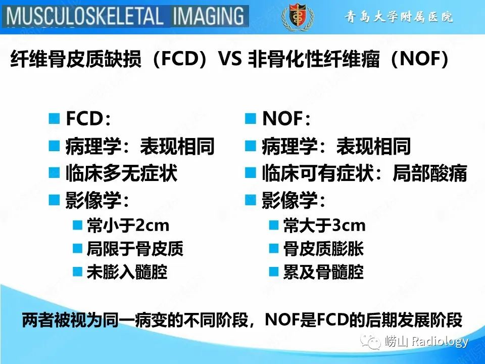 影像PPT - 【PPT】非骨化性纤维瘤-23