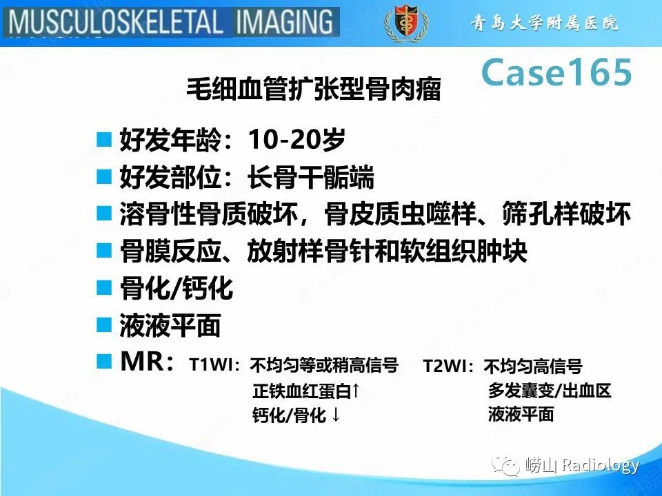 影像PPT - 【PPT】非骨化性纤维瘤-30