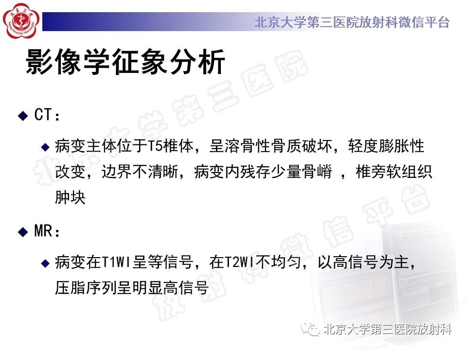 影像PPT - 【PPT】脊柱上皮样血管内皮瘤-7