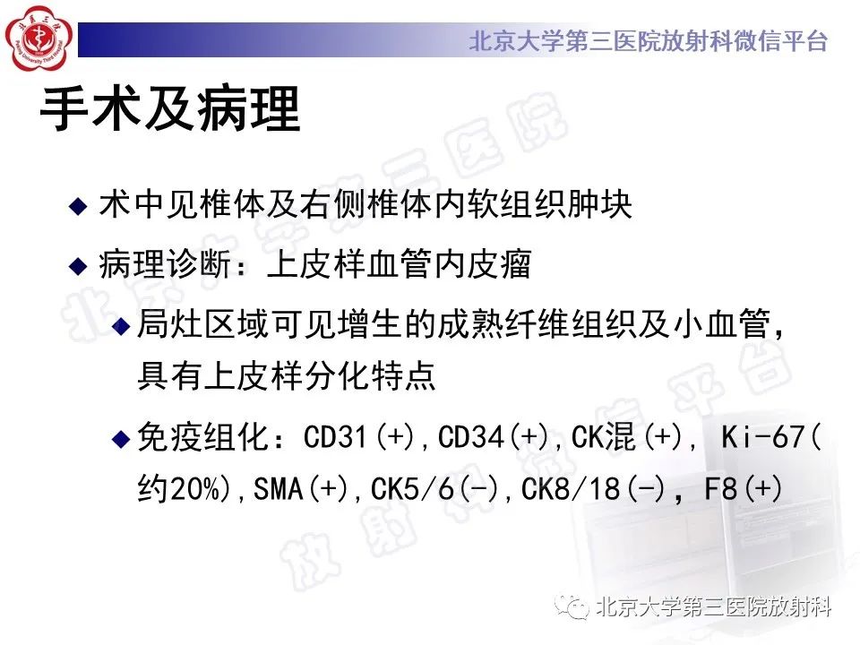 影像PPT - 【PPT】脊柱上皮样血管内皮瘤-10