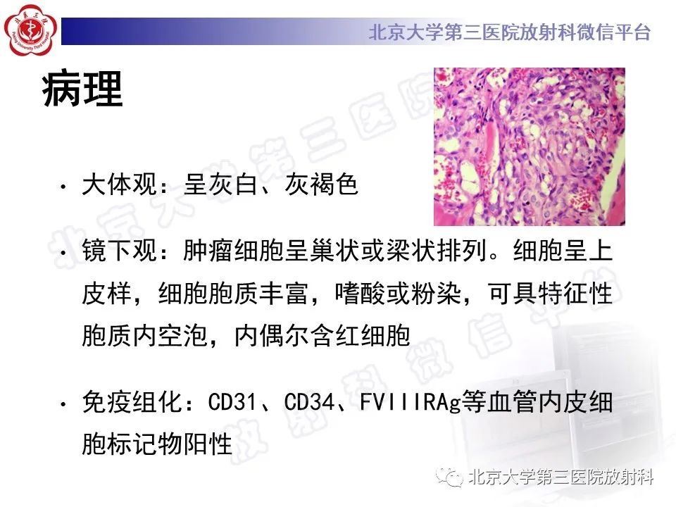 影像PPT - 【PPT】脊柱上皮样血管内皮瘤-15
