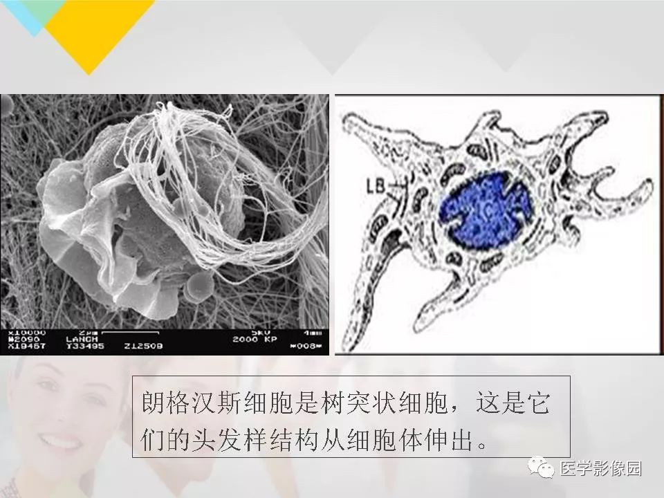 影像PPT - 【PPT】吸烟相关性间质性肺疾病的HRCT诊断-53