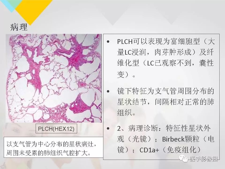 影像PPT - 【PPT】吸烟相关性间质性肺疾病的HRCT诊断-55