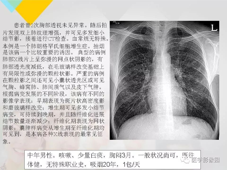 影像PPT - 【PPT】吸烟相关性间质性肺疾病的HRCT诊断-79