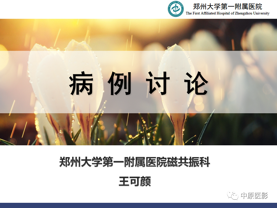 影像PPT - 【病例】眼眶周围淋巴瘤1例CT及MR-1