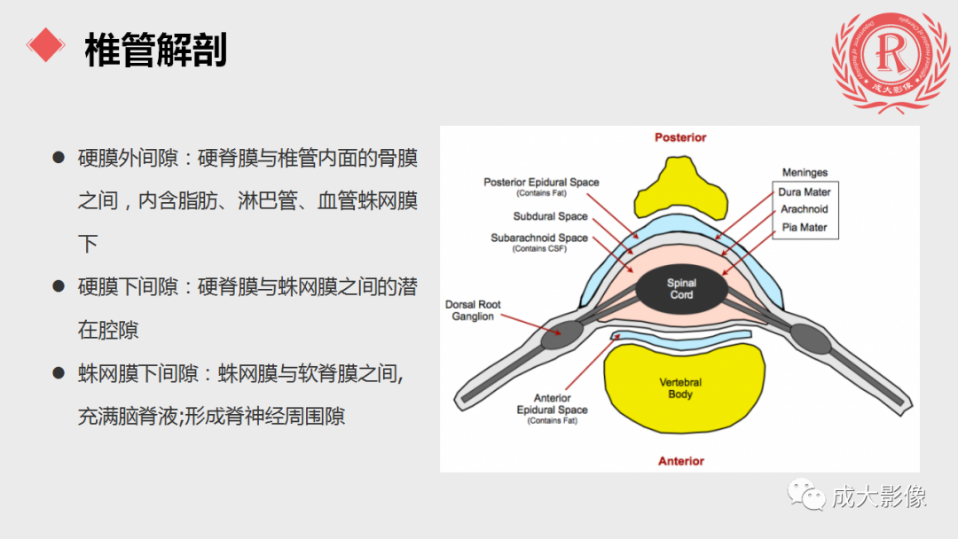 影像PPT - 【PPT】脊膜瘤影像表现-2