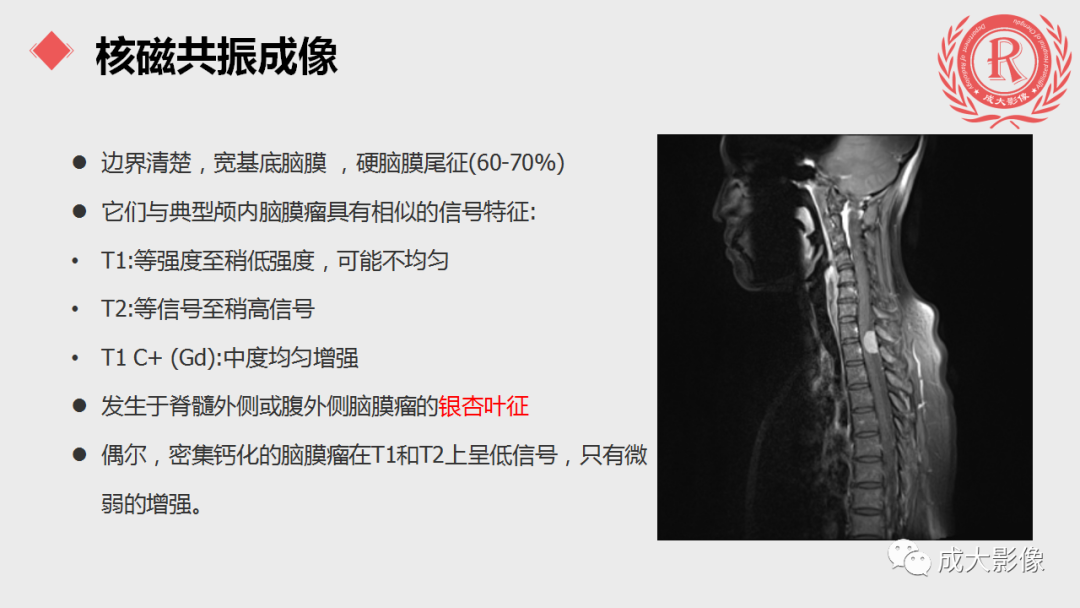 影像PPT - 【PPT】脊膜瘤影像表现-10
