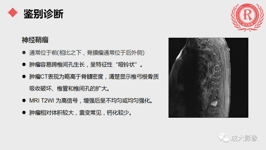 影像PPT - 【PPT】脊膜瘤影像表现-14