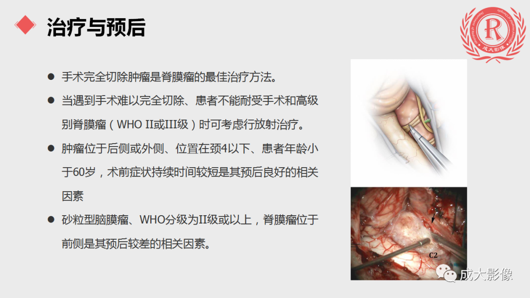 影像PPT - 【PPT】脊膜瘤影像表现-15