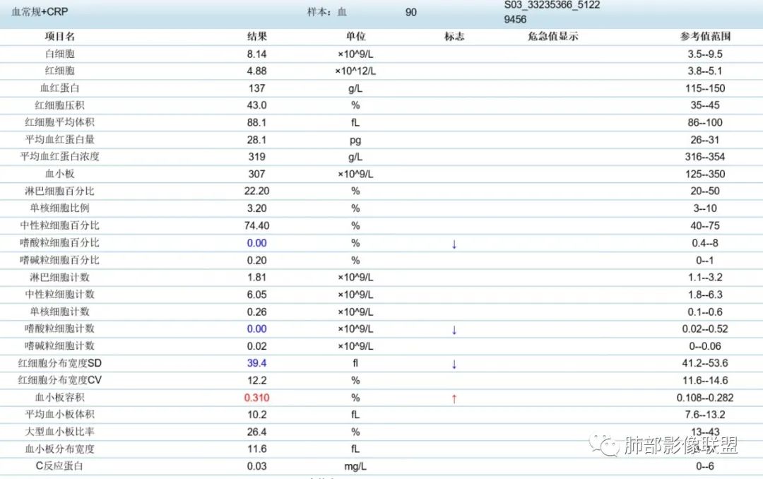 影像PPT - 【病例】拐枣或树芽征的肺部病变-29 影像PPT - 【病例】拐枣或树芽征的肺部病变-29