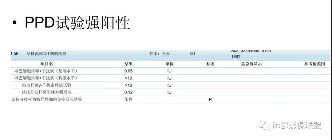 影像PPT - 【病例】拐枣或树芽征的肺部病变-39 影像PPT - 【病例】拐枣或树芽征的肺部病变-39