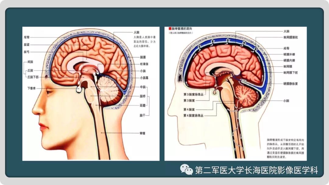 影像PPT - 【PPT】颅内囊性病变影像表现-9
