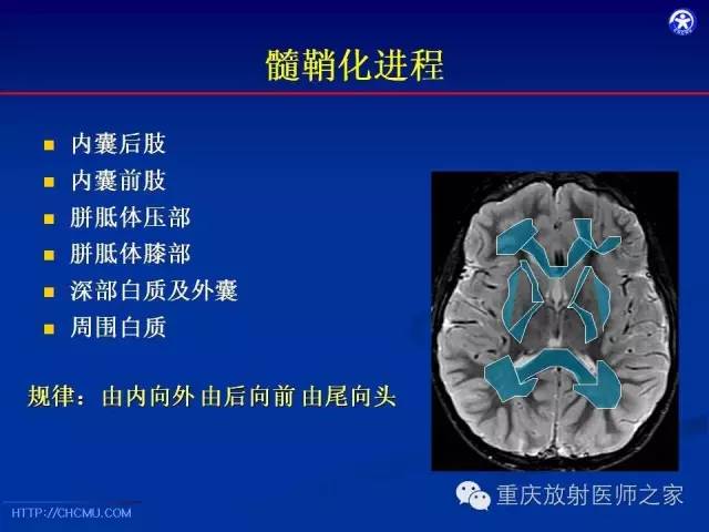 影像PPT - 【PPT】脑白质髓鞘化及相关疾病的MRI表现-8
