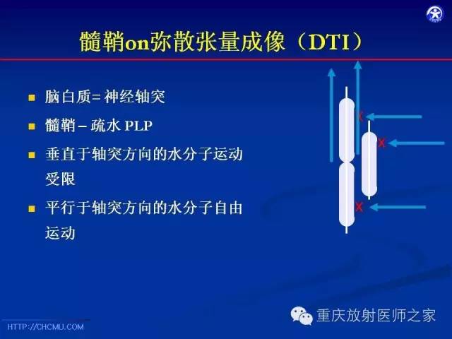 影像PPT - 【PPT】脑白质髓鞘化及相关疾病的MRI表现-16